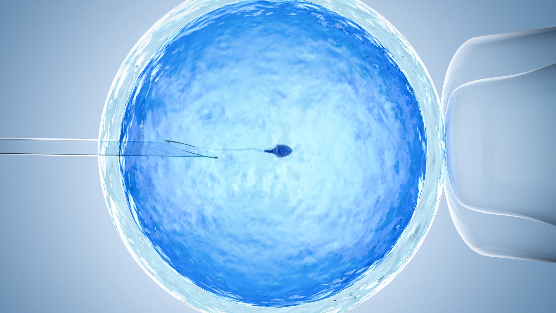 Intracytoplasmic sperm injection